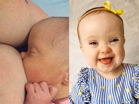 down syndrome tits|Breastfeeding a baby with Down Syndrome